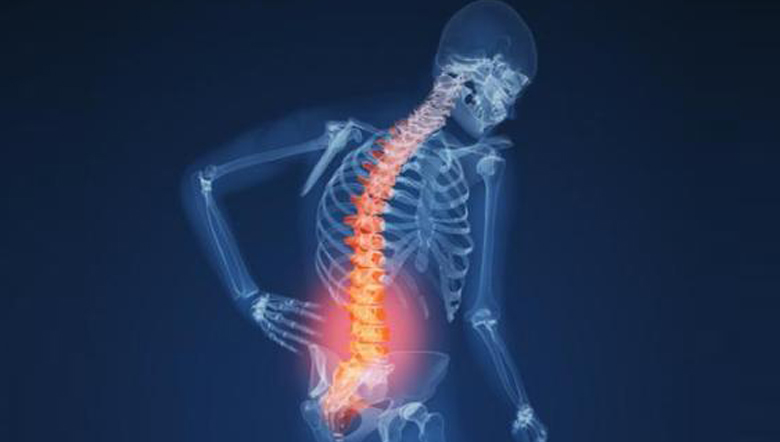 運(yùn)動(dòng)療法治療腰痛的專(zhuān)家共識(shí)